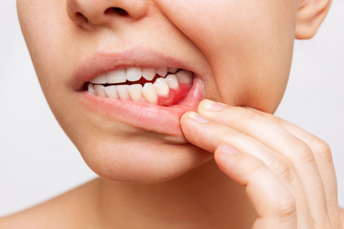 Preventing Gum Disease: Key Steps for Long-Term Oral Health